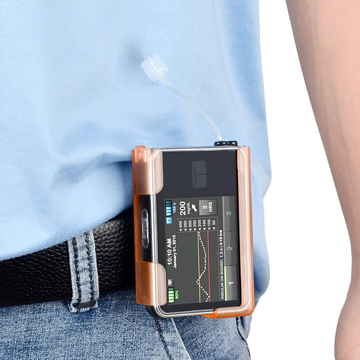 360° Rotating Case for Tandem tslim X2, Insulin Pump Holder for t:Slim/t:Slim G4, t: Holster Belt Clip with Cartridge Removal Tool Not Easy Fall & Break Pump Accessories