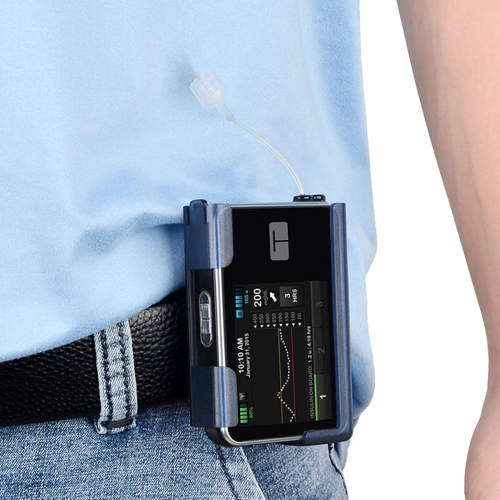 360° Rotating Case for Tandem tslim X2, Insulin Pump Holder for t:Slim/t:Slim G4, t: Holster Belt Clip with Cartridge Removal Tool Not Easy Fall & Break Pump Accessories