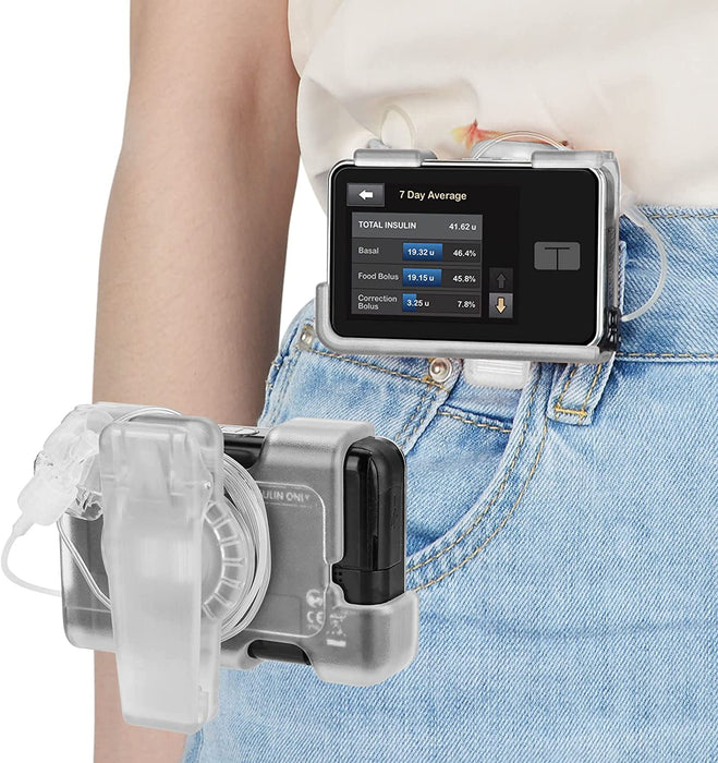 360° Rotating Case for tSlim X2 - Tandem Insulin Pump Holder for t:Sli ...