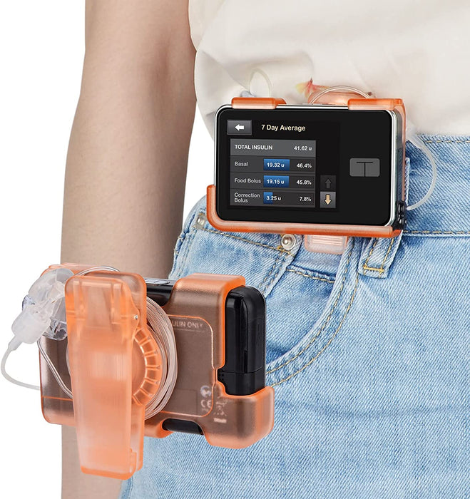 360° Rotating Case for tSlim X2 - Tandem Insulin Pump Holder for t:Slim t Slim G4 Accessories Spool Up Excess Tubing - t:Holster Smooth Edges Won't Peel Off Screen Cover